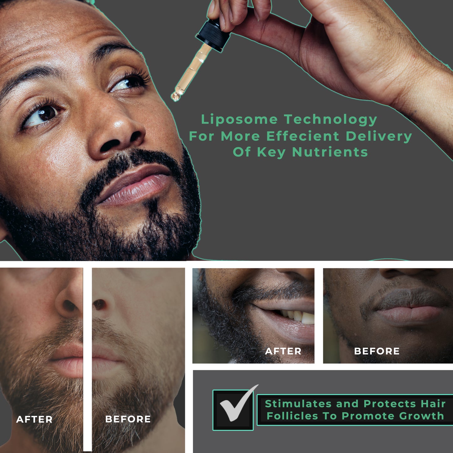 Beard Growth Oil w/ Tea Tree and Niacinamide